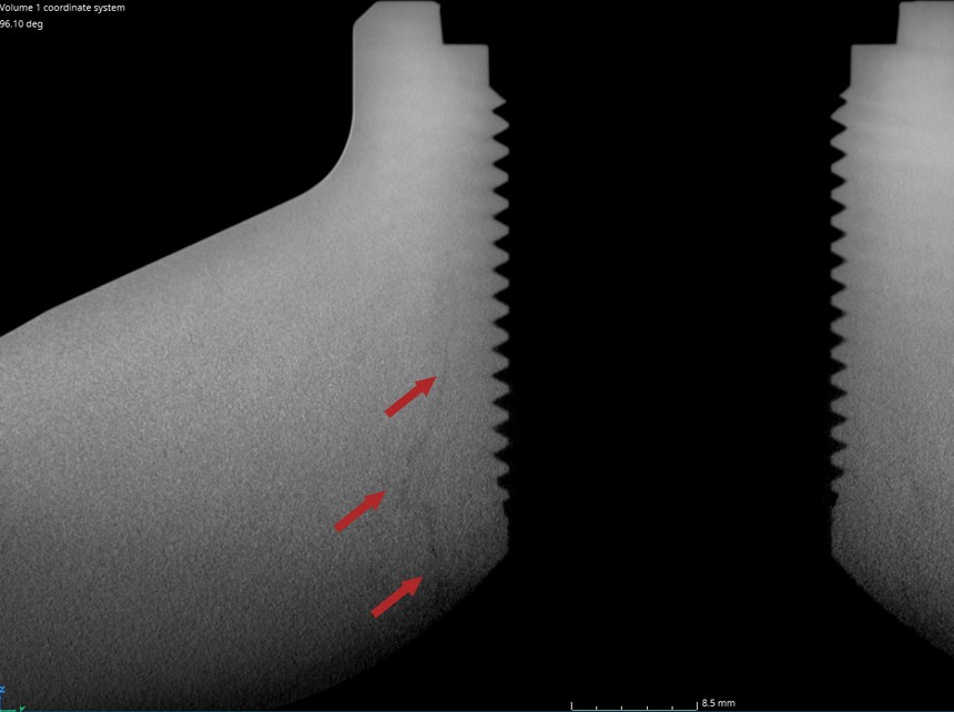 ct scan of crack